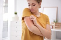 Problemi dermatologici
