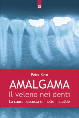 Amalgama: il Veleno nei Denti — Libro - 1