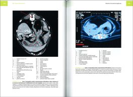 Anatomia Applicata e Topografia Regionale Veterinaria — Libro - 3