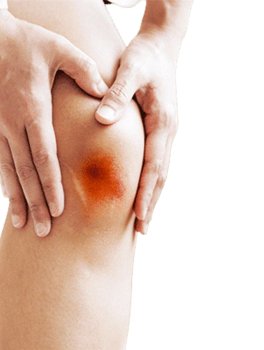 Cicatril® Crema - 8