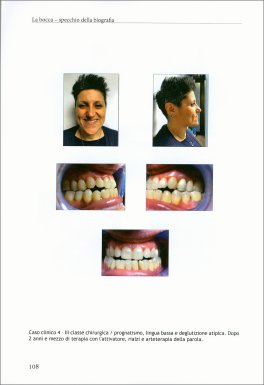 La Bocca Specchio della Biografia — Libro - 3