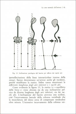 La Cura Naturale dell'Artrosi — Libro - 3