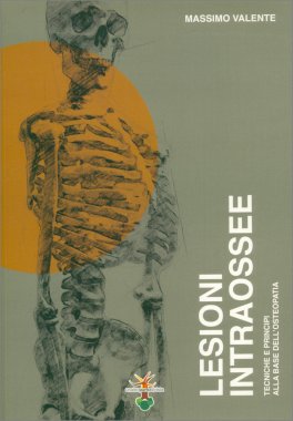 Lesioni Intraossee — Libro - 1