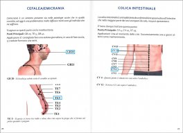 Moxibustione — Libro - 3