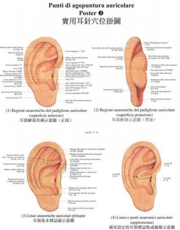 Poster Punti di Agopuntura Auricolare 1-2-3 — Poster - 1