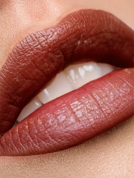 Rossetto Nigritella - 3