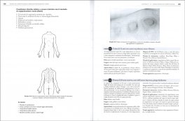 Terapia di Coppettazione in Medicina Tradizionale Cinese — Libro - 3