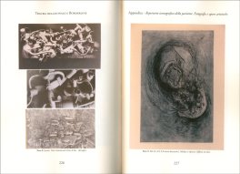 Trauma Relazionale e Borderline — Libro - 3