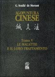 Agopuntura Cinese — Libro