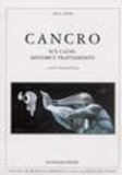 Cancro - Sue Cause, Sintomi e Trattamento — Libro