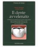Il Dente Avvelenato — Libro