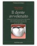 IL DENTE AVVELENATO
"La Sindrome da Metalli Tossici e il rebus della tossicità degli amalgami dentari"
di Adolfo Panfili

