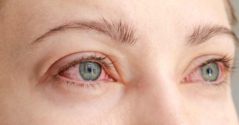 Eufrasia: a cosa serve, benefici per occhi e allergie e come usarla