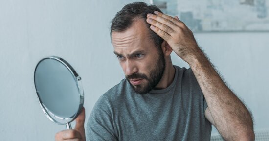 Alopecia androgenetica: i rimedi naturali