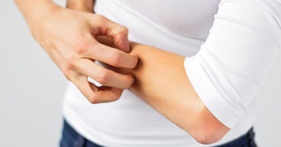 Se soffri di dermatite da contatto questi estratti vegetali ti possono aiutare