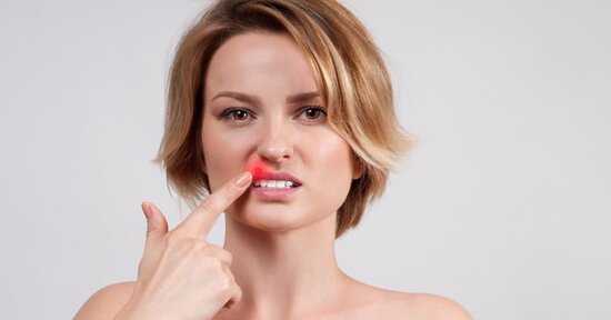 Herpes labiale: 7 rimedi naturali