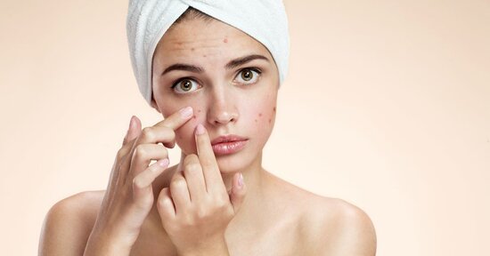 Quando la pelle fa i capricci. Rimedi naturali per l’acne