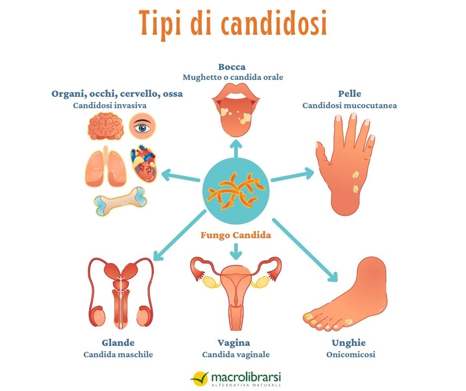 La candida può interessare diverse parti del corpo