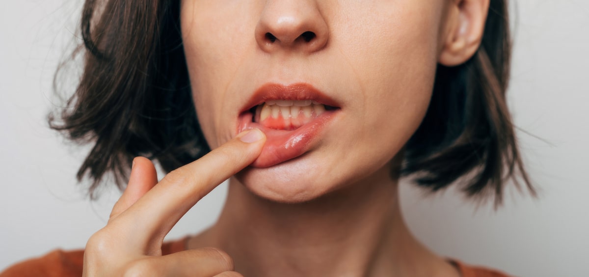Donna con problema di gengive infiammate