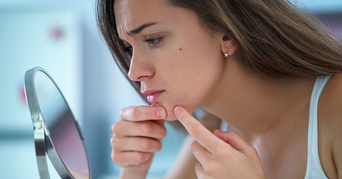 Donna che si schiaccia un brufolo davanti allo specchio