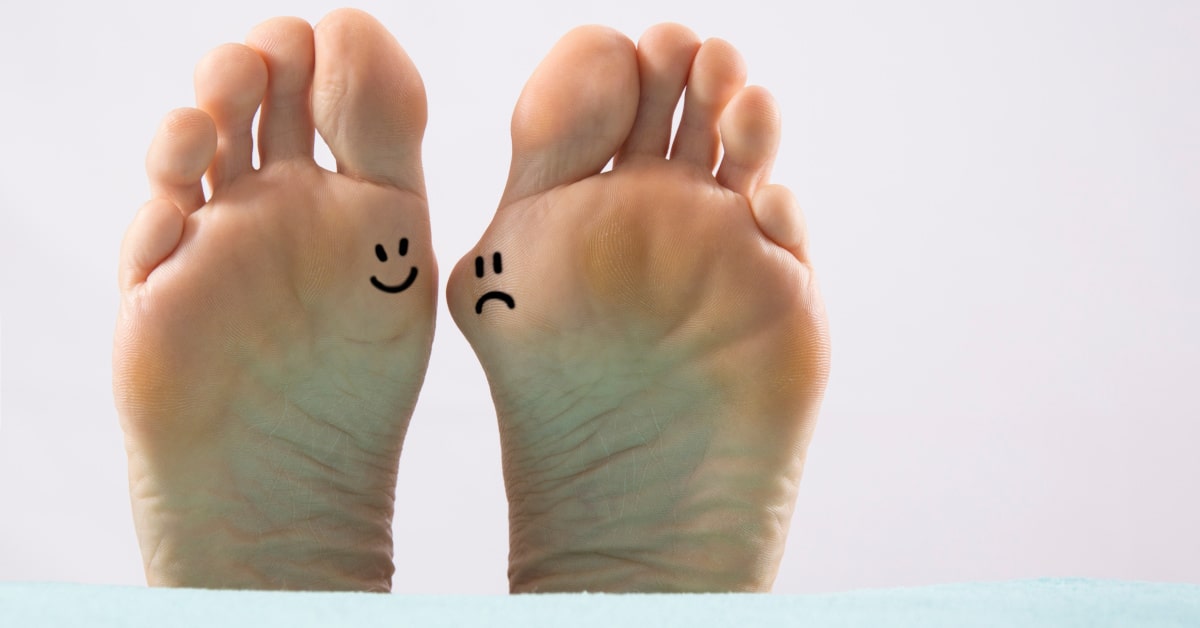 Piedi con cipolla da alluce valgo