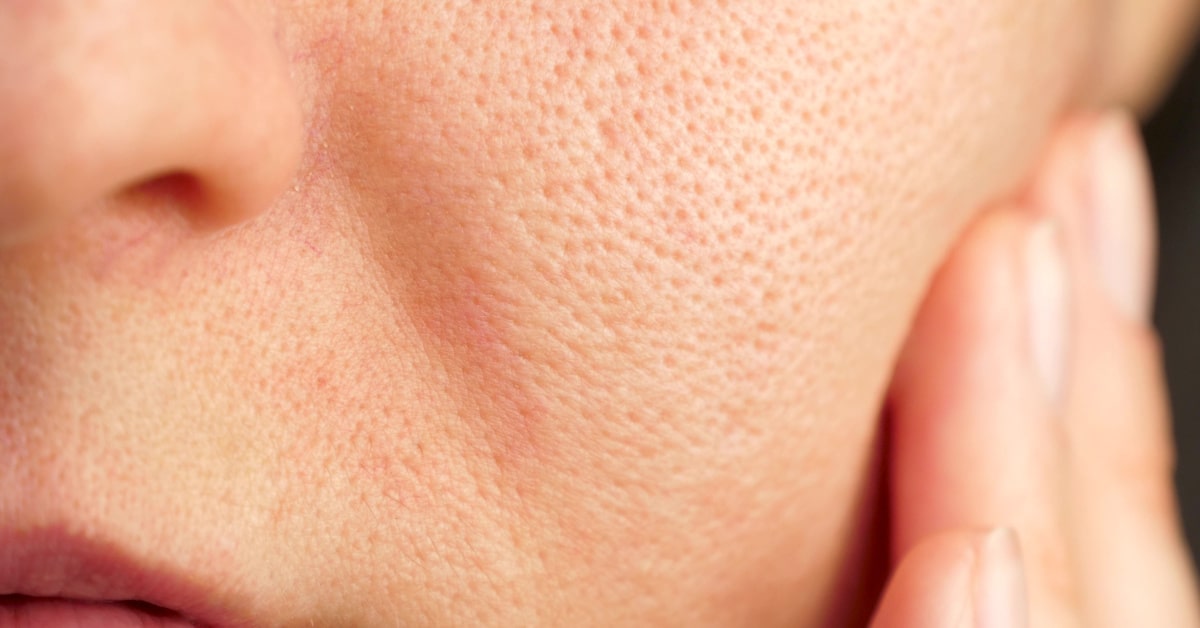 Primo di viso di donna con pori dilatati
