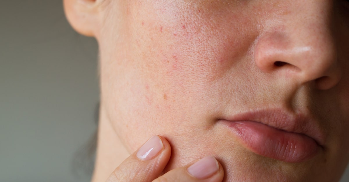 Viso di donna con imperfezioni 