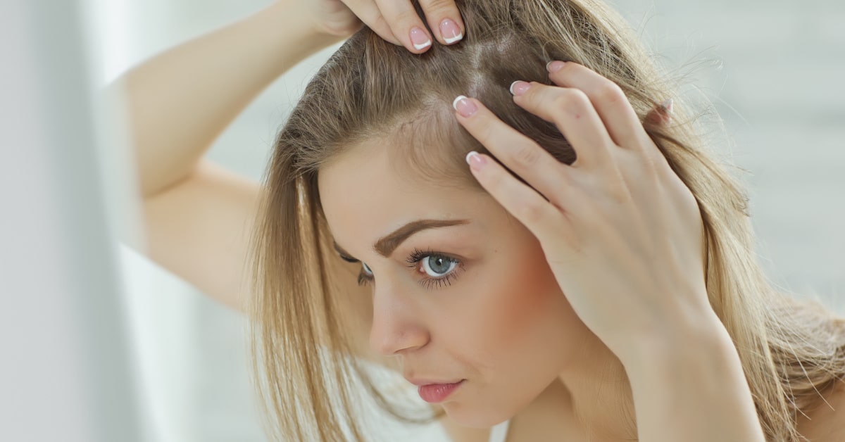 Donna con diradamento dei capelli per caduta eccessiva