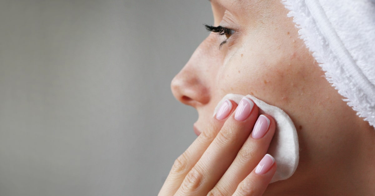 Donna con acne in viso, trattamento con tea tree oil