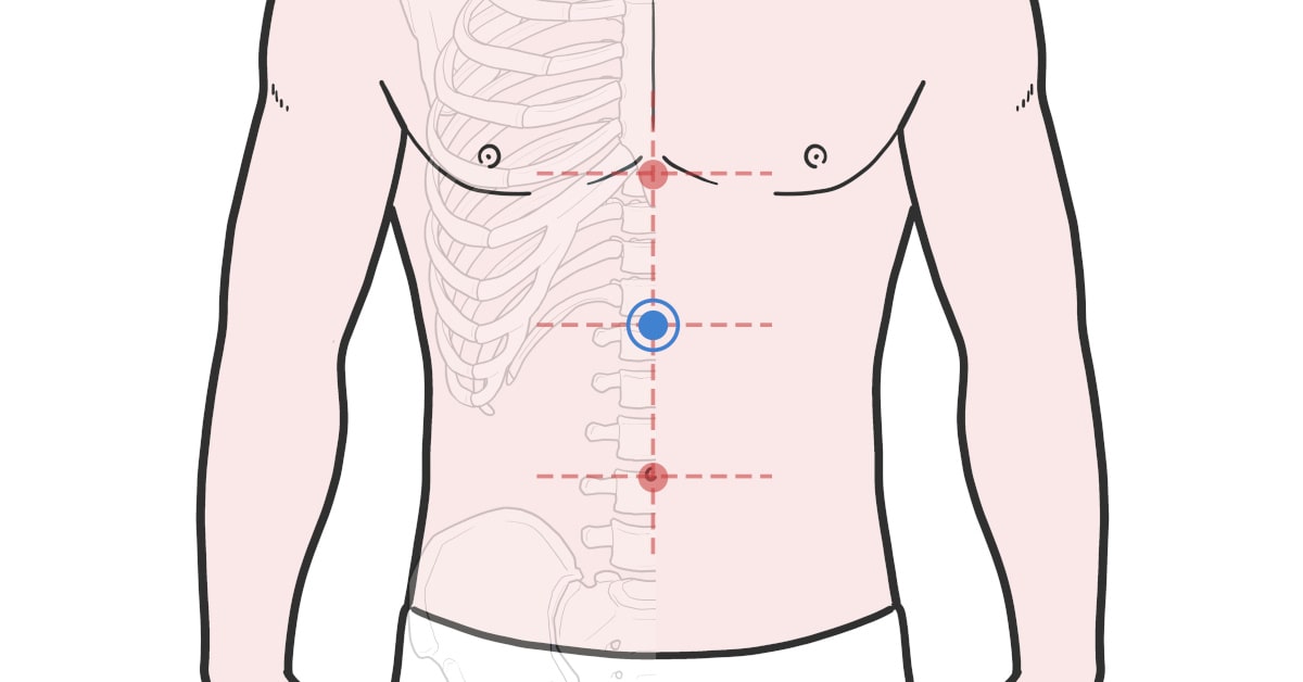 Punto 12 di Vaso Concezione (REN12)