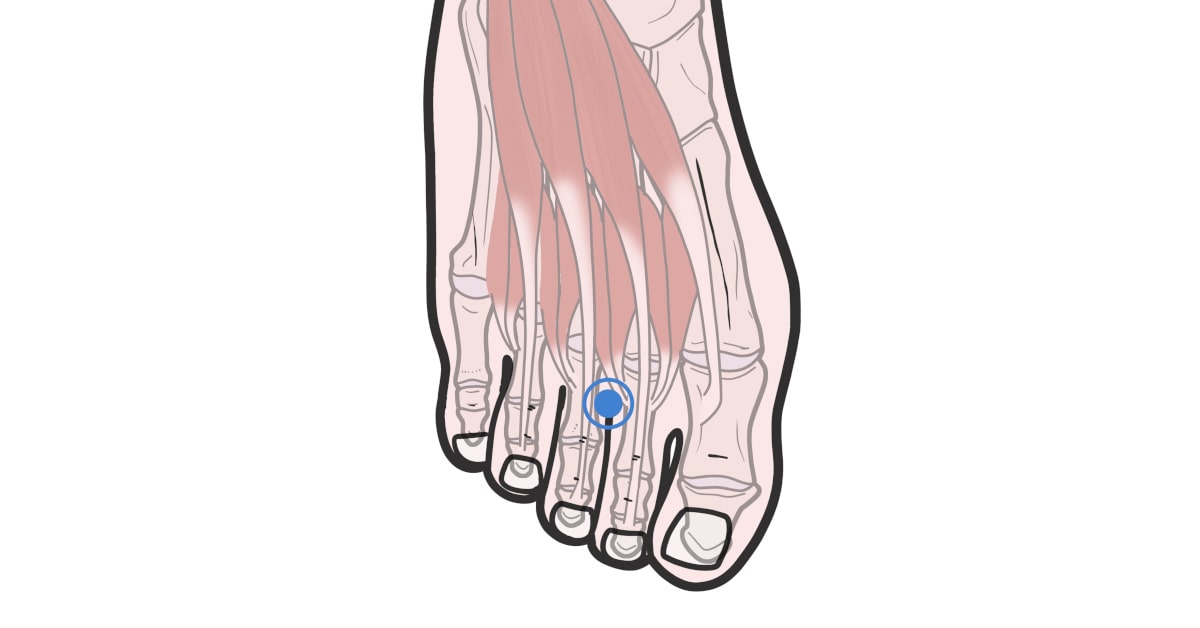 Punto 44 dello stomaco (ST44)