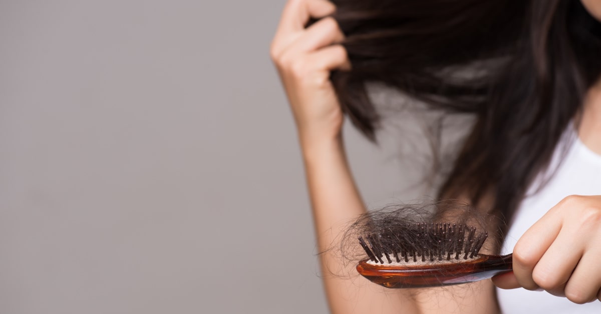 La perdita di capelli &egrave; uno dei sintomi di carenza di vitamina D