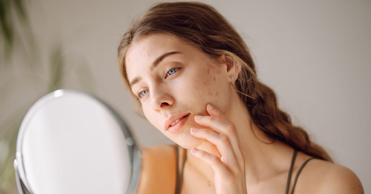 La linfa di betulla mantiene la pelle tonica, elastica e ben idratata