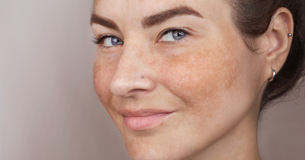 Come scegliere cosmetici se hai allergia al nichel